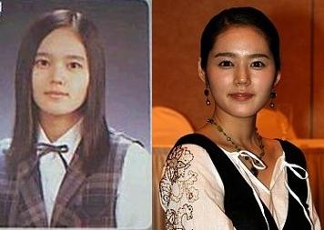韩佳人整容前后对比照 韩佳人整容前后对比照